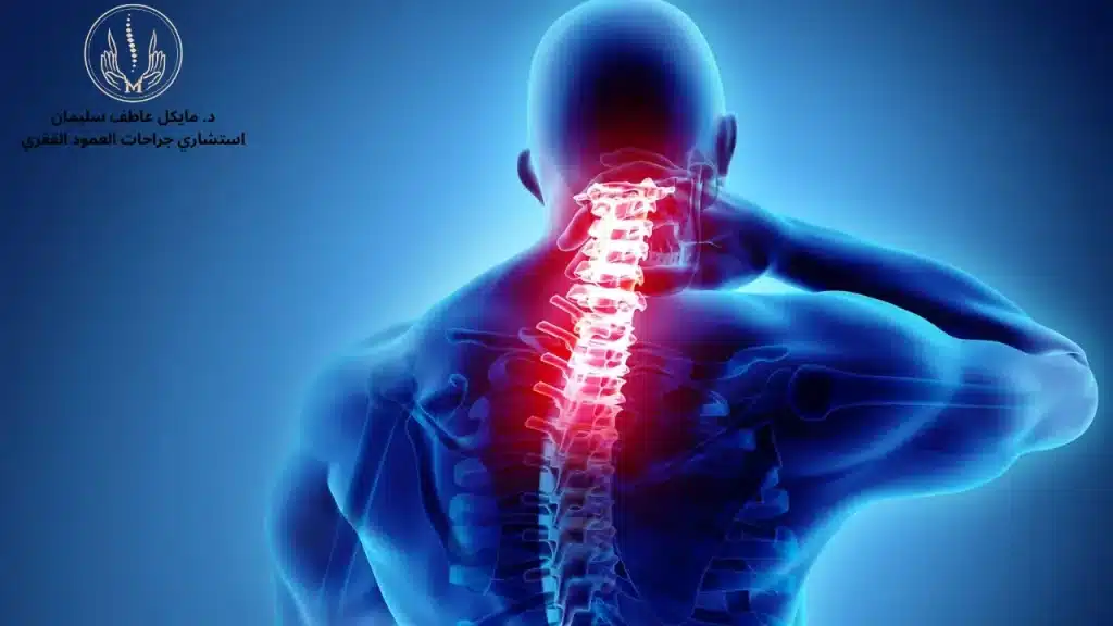 أعراض الانزلاق الغضروفي العنقي​ من الرقبة إلى الذراع ومتى تصبح خطيرة؟ - د. مايكل عاطف