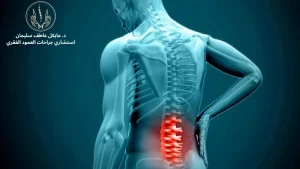 الفرق بين الانزلاق الغضروفي وانزلاق الفقرات - الأسباب والأعراض وخيارات العلاج - د. مايكل عاطف