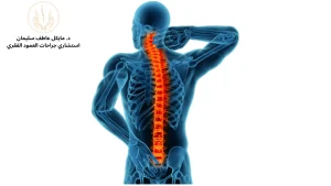أفضل دكتور لعلاج درجات اعوجاج العمود الفقري - د. مايكل عاطف