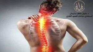 أسباب اعوجاج العمود الفقري وكيف يمكن علاجه؟ - د. مايكل عاطف