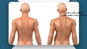 د. مايكل عاطف أشهر دكتور عمود فقري في مصر