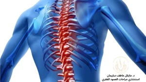 من هو الطبيب المختص بالعمود الفقري؟ - د. مايكل عاطف