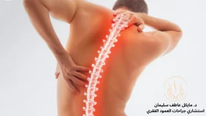 أهم حالات العمود الفقري التي تتطلب جراحة - د. مايكل عاطف