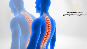 د مايكل عاطف أفضل دكتور لعلاج الجنف فى مصر وأحدث طرق التشخيص