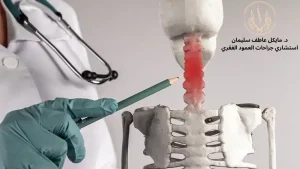 د. مايكل عاطف أفضل جراح لعلاج الاعتلال النخاعي الشوكي العنقي