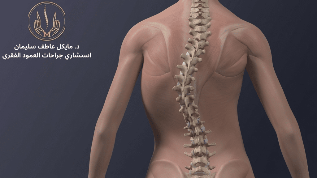 هل جراحات اعوجاج العمود الفقري امنه؟ - د. مايكل عاطف